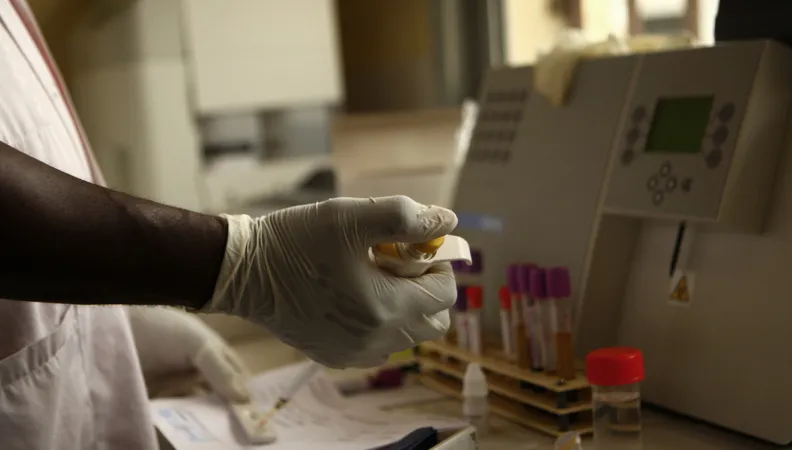 Coronavirus : l’AFD et l’Inserm mettent en oeuvre un dispositif de soutien de 1,5 million d’euros pour l’Afrique francophone